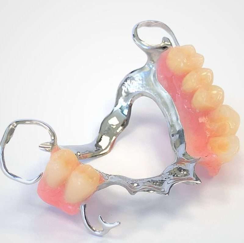 What Are Chrome Dentures - O'Hagan & Murray Dental Practice